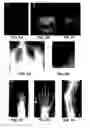 Fig. 04 - Method for identifying markers in radiographic images