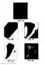 Fig. 05 - Method for identifying markers in radiographic images