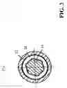 Fig. 04 - Belt tensioning device