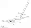 Fig. 05 - Device for the injection of drugs into microvessels