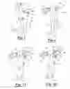 Fig. 02 - Brace hosiery apparatus, assembly and method of use