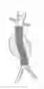 Fig. 04 - Catheter-based fastener implantation apparatus and methods