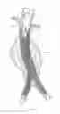Fig. 05 - Catheter-based fastener implantation apparatus and methods