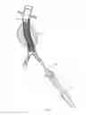 Fig. 17 - Catheter-based fastener implantation apparatus and methods