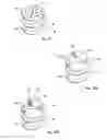 Fig. 26 - Catheter-based fastener implantation apparatus and methods