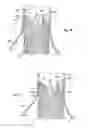 Fig. 33 - Catheter-based fastener implantation apparatus and methods