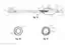 Fig. 02 - Medical device balloon