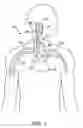 Fig. 02 - Automatic baroreflex modulation based on cardiac activity