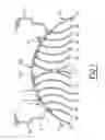Fig. 02 - Temperature exchanging element made by extrusion, and its applications