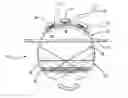 Fig. 01 - Audio speaker with partially spherical speaker housing and escutcheon