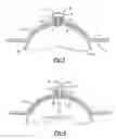 Fig. 06 - Audio speaker with partially spherical speaker housing and escutcheon
