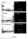 Fig. 02 - Vascular targeting of ocular neovascularization