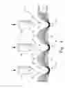 Fig. 05 - Joint resurfacing orthopaedic implant and associated method