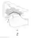 Fig. 06 - Joint resurfacing orthopaedic implant and associated method