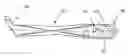 Fig. 01 - Device for adjusting tooth and/or jaw malpositions