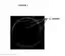 Fig. 02 - Fluorogenic selective and differential medium for isolation of 