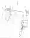 Fig. 06 - Apparatus and method for treatment of infected nail