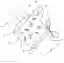 Fig. 01 - Device for the prevention of thumb sucking