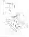 Fig. 02 - Device for the prevention of thumb sucking