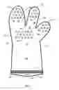 Fig. 07 - Glove with sealing elements maintaining opening for hand