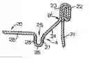 Fig. 01 - Can end
