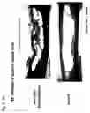 Fig. 07 - Method for treating and/or preventing spinal cord injury