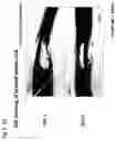 Fig. 08 - Method for treating and/or preventing spinal cord injury