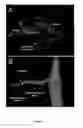 Fig. 02 - Compositions and methods for enhancing axon regeneration
