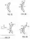 Fig. 15 - Drug delivery system and method
