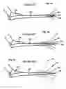 Fig. 02 - Methods for creating large scale focused blade deflections