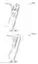 Fig. 07 - Systems, devices and methods relating to a shape resilient sling-like support for treating urinary incontinence