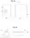 Fig. 07 - Radiation treatment table and method for prone breast radiation treatment
