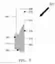 Fig. 07 - Combination eating utensil