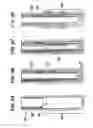 Fig. 05 - Techniques and systems associated with perforation and the installation of downhole tools