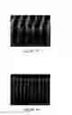 Fig. 05 - Etching methods