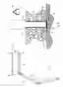 Fig. 02 - Fence post anchoring system and method