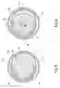 Fig. 06 - Fast fasten and loose resistant bolt and nut structure
