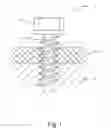 Fig. 02 - Anti-loose screw