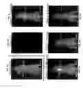Fig. 06 - Non-isotopic detection of osteoblastic activity in vivo using modified bisphosphonates
