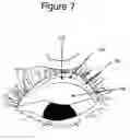 Fig. 07 - Eye treatment
