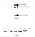 Fig. 03 - Selective killing of cells by activation of double-stranded RNA dependent protein kinase-PKR