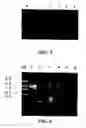 Fig. 03 - Motoneuronotrophic factor gene sequences