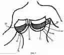 Fig. 02 - Support bra