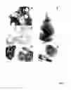 Fig. 02 - Methods for therapy of neurodegenerative disease of the brain