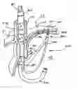 Fig. 01 - Apparatus and method for securing the stomach to the diaphragm for use, for example, in treating hiatal hernias and gastroesophageal reflux disease