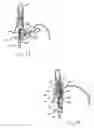 Fig. 08 - Apparatus and method for securing the stomach to the diaphragm for use, for example, in treating hiatal hernias and gastroesophageal reflux disease
