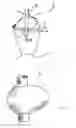 Fig. 02 - Asymmetrically inflating flexi-tip gastroplasty calibration tube