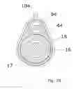 Fig. 31 - Dilator