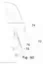 Fig. 41 - Dilator