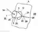Fig. 01 - Airbag module